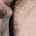 Understanding the Rapid Spread of Bed Bug Infestations