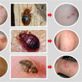 Understanding Bed Bug Bites: Identification and Facts