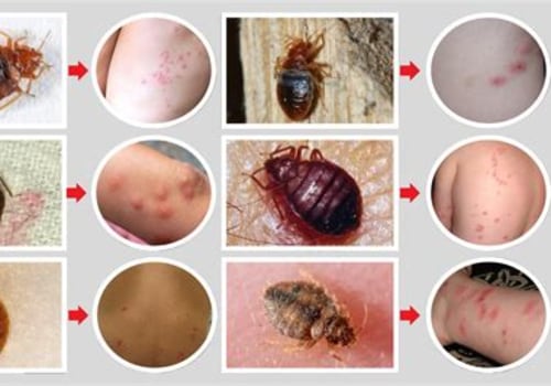 Understanding Bed Bug Bites: Identification and Facts